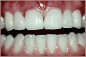 smile with all teeth