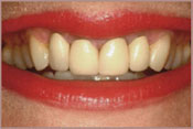 smile with yellow teeth