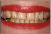 smile with yellow teeth